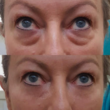 Cargar imagen en el visor de la galería, Crema rejuvenecedora